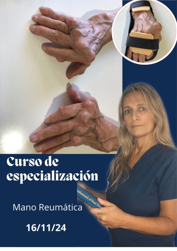 Curso de Especialización en Mano Reumática Ferulaje