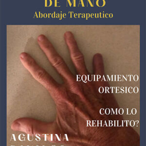 Curso de Abordaje Terapéutico en Pacientes Amputados de Mano