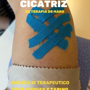 Manejo de Cicatriz en Terapia de Mano