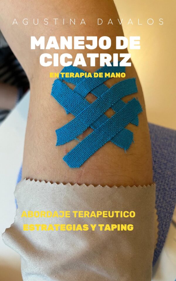 Manejo de Cicatriz en Terapia de Mano